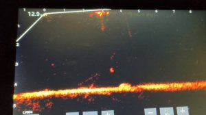 Казанская щука! Garmin panoptix lvs34