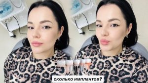 ИМПЛАНТАЦИЯ ЗУБОВ | моя история, отёк и боль