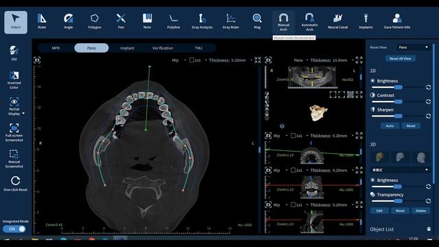 Eighteeth FinScan F350 — Panoramic Mode смотреть онлайн