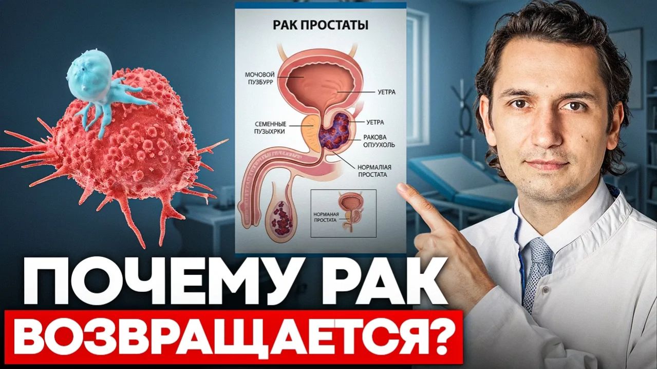 Рак глазами онколога: почему он исчезает и возвращается? Все про Ремиссию и Рецидив Рака