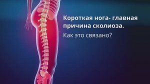 Короткая нога- причина сколиоза. Как это связано?