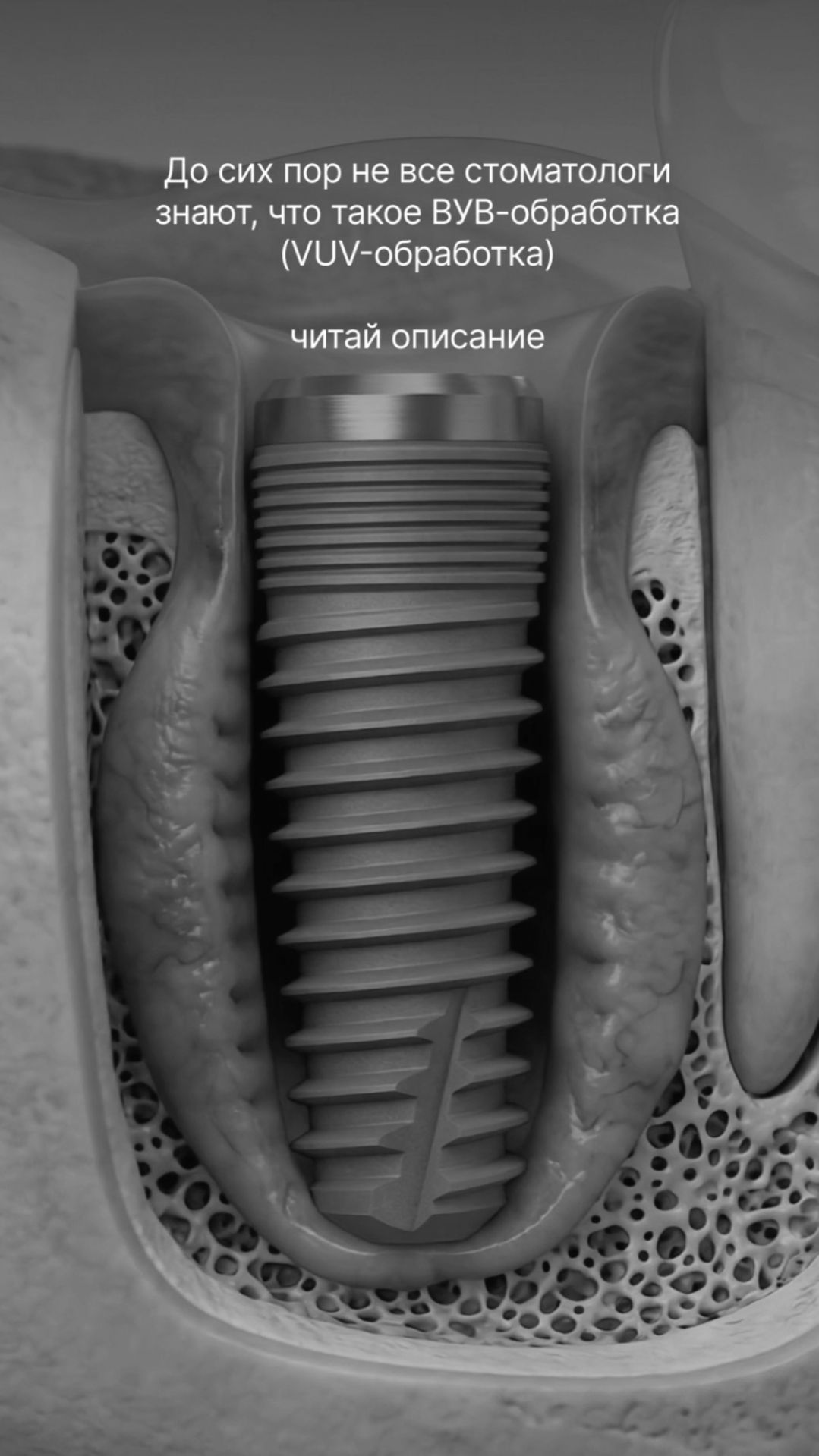 Что такое ВУВ-обработка (VUV-обработка) и почему о ней сейчас так много говорят? 👇🏻
