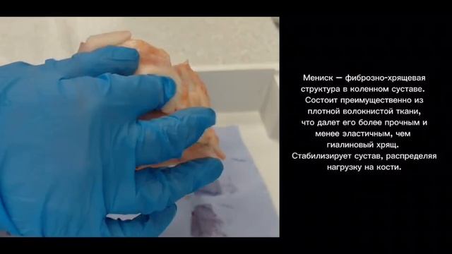 Препарирование кости