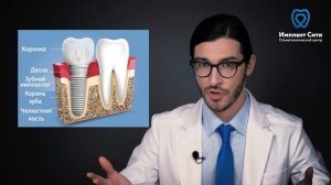 Что же такое зубной имплант и из чего он состоит?