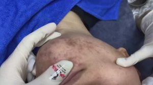 035 • Relax Spa • АСМР • Acne collection