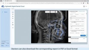 Eighteeth FinScan F350 — Cephalometric X-ray Analysis Report