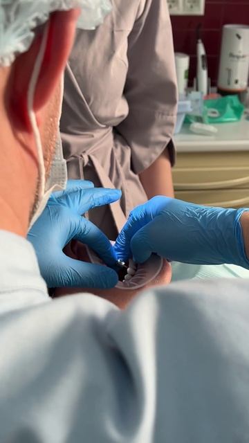 Подглядываем за установкой протеза 😉 Подробнее в канале 🦷