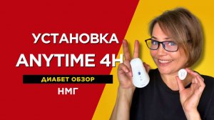 Установка датчика НМГ Anytime 4H // Диабет обзор