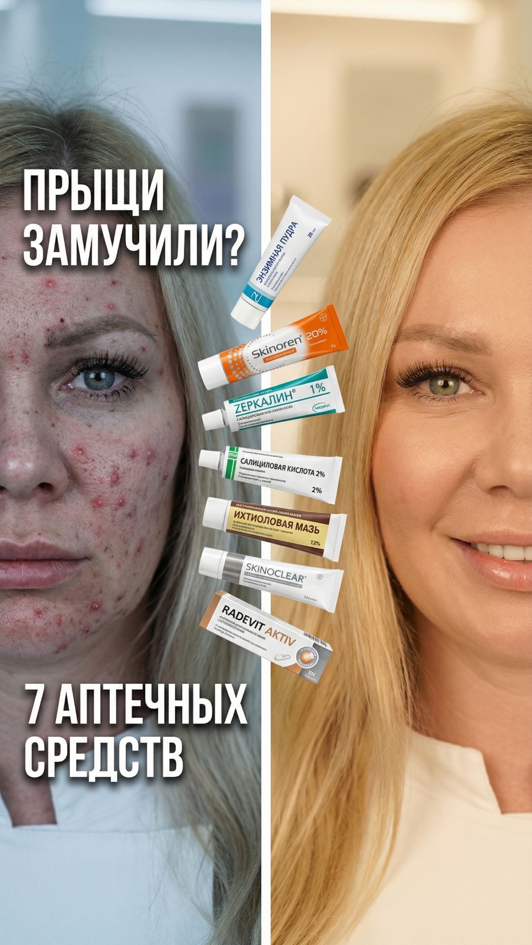 Прыщи замучили? 😬 7 аптечных средств которые реально работают👇