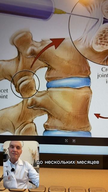 Что такое фасеточная блокада?