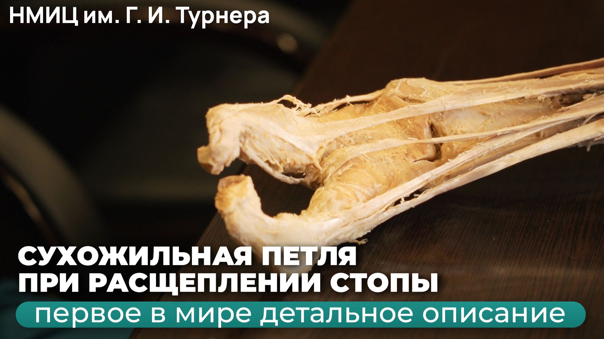 НМИЦ им. Г. И. Турнера: впервые в мире детально описана 