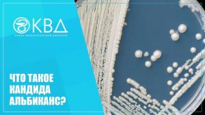 ✅ 1491  Что такое Кандида альбиканс