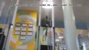 после шунтирования 2016 я не хожу уже год . две грыжи по 10 мм. меня Парализова́ло.