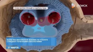 27 марта в России отмечают День нефролога