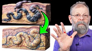 ВАРИКОЗ И ПОГОДА: ПОКАЗЫВАЮ, КАК ПОМОЧЬ ВЕНАМ ДВУМЯ ПАЛЬЦАМИ