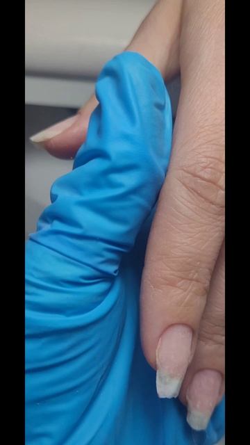 Тонкие, скрученые ногти