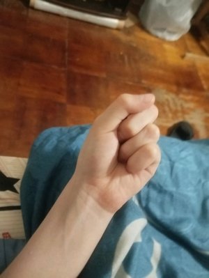 ААААА У МЕНЯ 4 ПАЛЬЦА😱😱😱😱😱😱