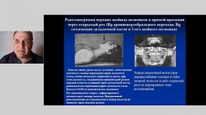 дмн профессор Бояджан Григорий Граерович. Рентгенология