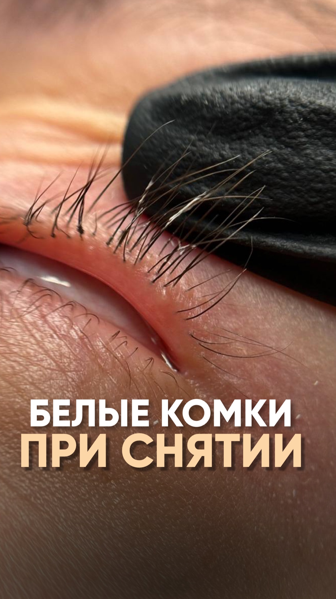 Опять эти белые комочки😬 Что с ними делать🤦🏼♀️