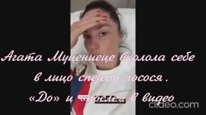 Агата Муцениеце вколола себе в лицо сперму лосося. «До» и «после» в видео