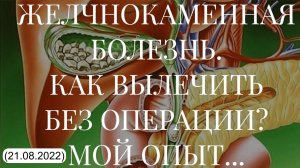 ЖЕЛЧНОКАМЕННАЯ БОЛЕЗНЬ. КАК ВЫЛЕЧИТЬ БЕЗ ОПЕРАЦИИ? МОЙ ОПЫТ... (21.08.2022)