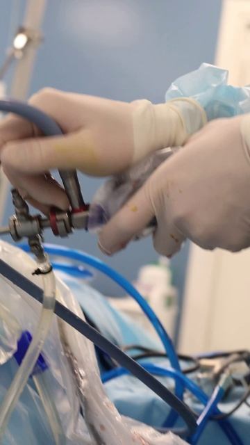 Артроскопия плечевого сустава