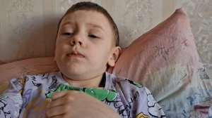 МНЕ ВЫРВАЛИ 2 ЗУБА... полный разказ как это было