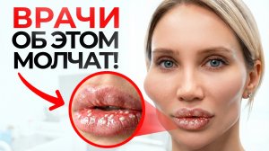 Не колите филлеры – 5 вещей, о которых вам не расскажут