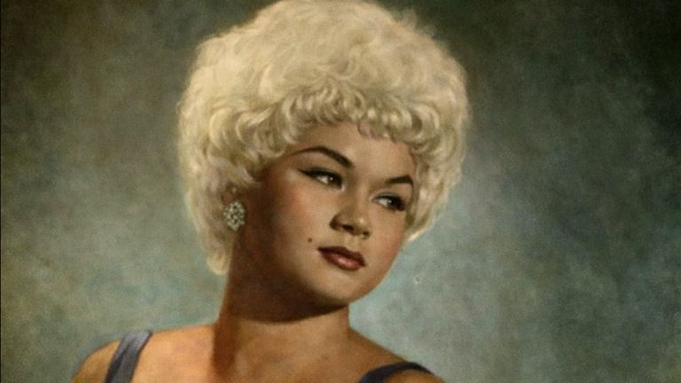 Болезнь Крейтцфельдта–Якоба