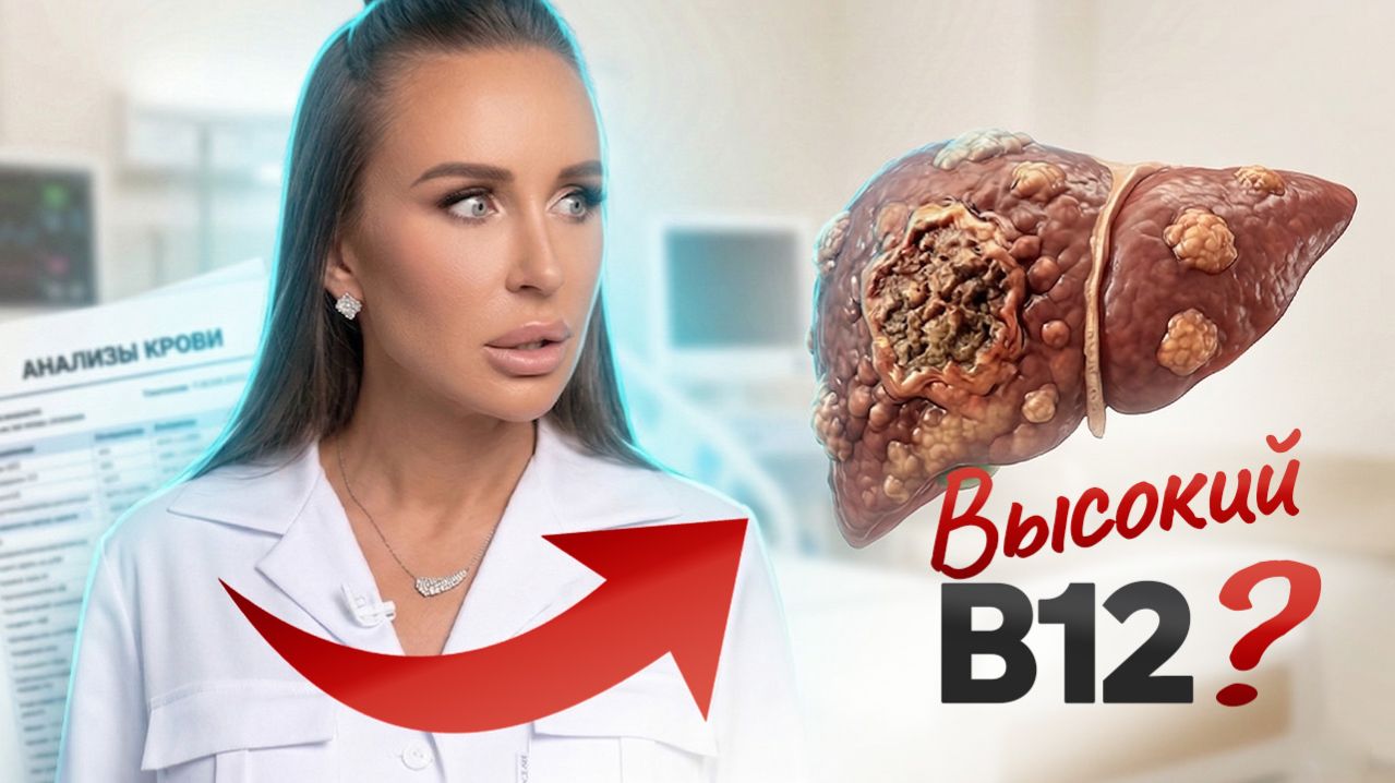 Высокий В12 = РАК? — или как анализы могут вас обмануть?