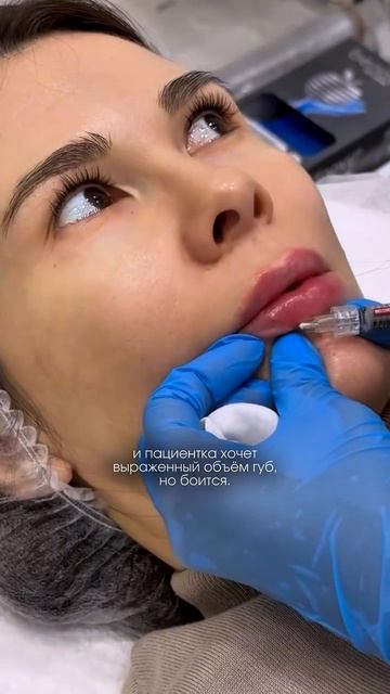 С КАКОГО ОБЪЕМА ЛУЧШЕ ВСЕГО НАЧАТЬ ДЕЛАТЬ КОРРЕКЦИЮ ГУБ?