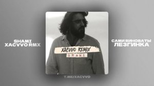 SHAMI - Сами виноваты - (xᴀᴄᴠᴠᴏ ʀᴍx)  | Lezginka 2025