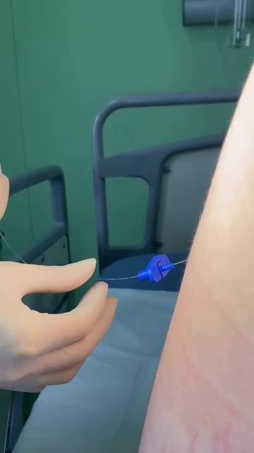 Эпидуральная анестезия — это не просто «укол в спину». Показываем закулисье работы анестезиолога