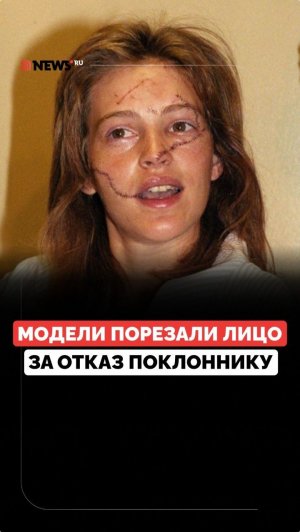 История Марлы Хэнсон. Модели порезали лицо за отказы мужчине