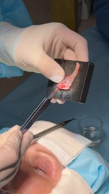 Сложный, интересный и очень показательный случай 🔥