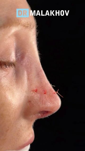 ДО/ПОСЛЕ на операционном столе 😍