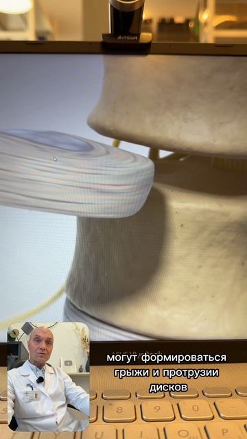 Что такое остеохондроз?