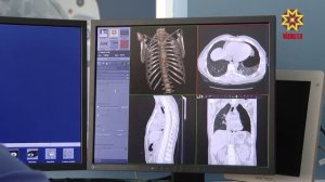 16-летний питбайкер, попавший в ДТП,проходит лечение  в Республиканской детской клинической больницы