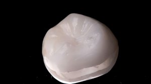 Подготовка временной коронки