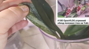 #183 ОрхоVLOG Что получается, а что нет. Промежуточный результат лечения в течении месяца