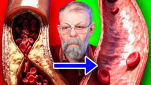 10 УПРАЖНЕНИЙ ИЗ НОВОГО КУРСА "ЗАБИТЫМ СОСУДАМ - НЕТ"