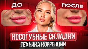 Носогубные складки. Техника коррекции для видимого и безопасного результата