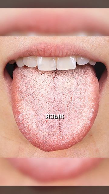 Вздутие на всё подряд Вот настоящая причина