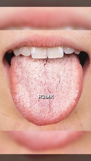 Вздутие на всё подряд Вот настоящая причина