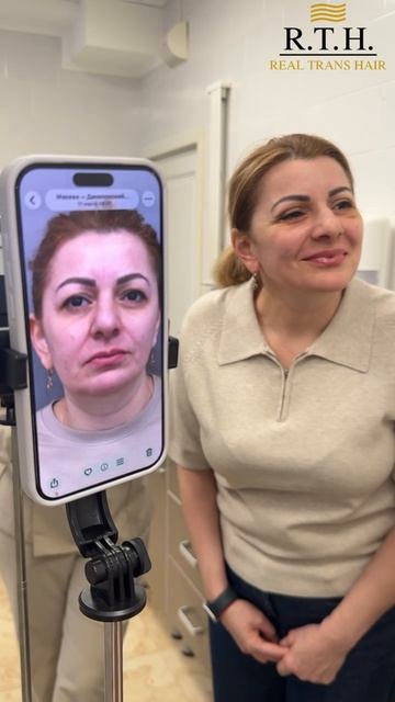 7 дней после блефаропластики