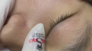 047 • Acne collection • АСМР • Relax Spa