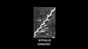 under-our-skin_1080p.mp4