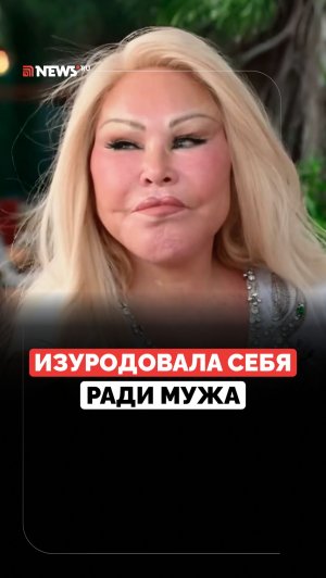Жертва пластических операций. Зачем Джоселин Вильденштейн изменила себя до неузнаваемости?