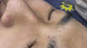 046 • Acne collection • АСМР • Relax Spa