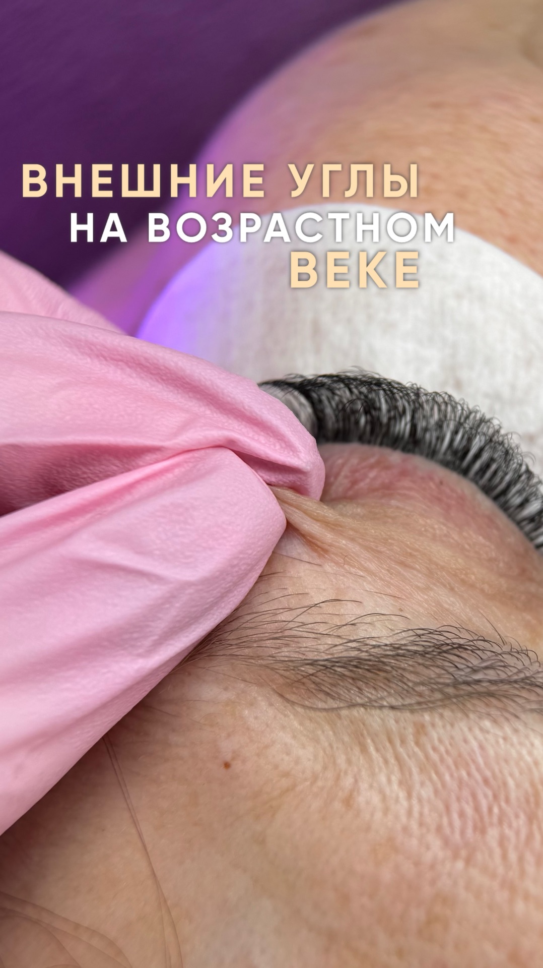 Как натягивать внешний угол на возрастном веке?